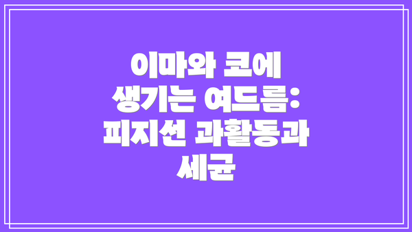 이마와 코에 생기는 여드름: 피지선 과활동과 세균
